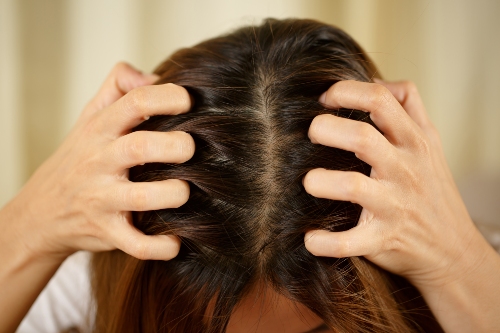 femme qui se gratte la tête