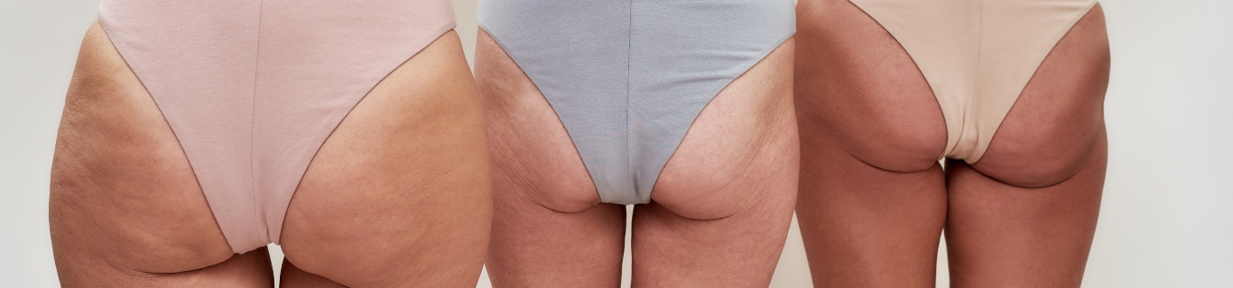 Le bicarbonate de soude est-il efficace pour éliminer la cellulite ?