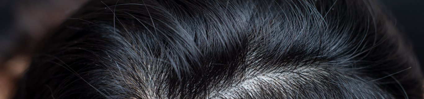 Le bicarbonate de soude peut-il avoir son utilité pour les cheveux ?