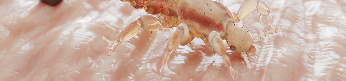 Comment utiliser le bicarbonate contre les poux ?